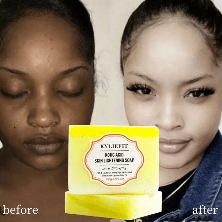 Kyliefiti Kojic Acid Skin Lightening Soap