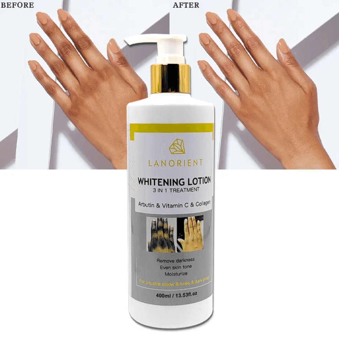 Lanorient Whitening Lotion 3-in-1 Treatment