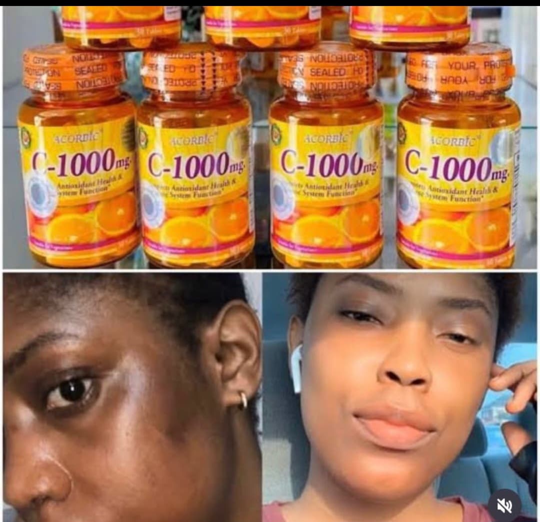 Acorbic C-1000 mg
