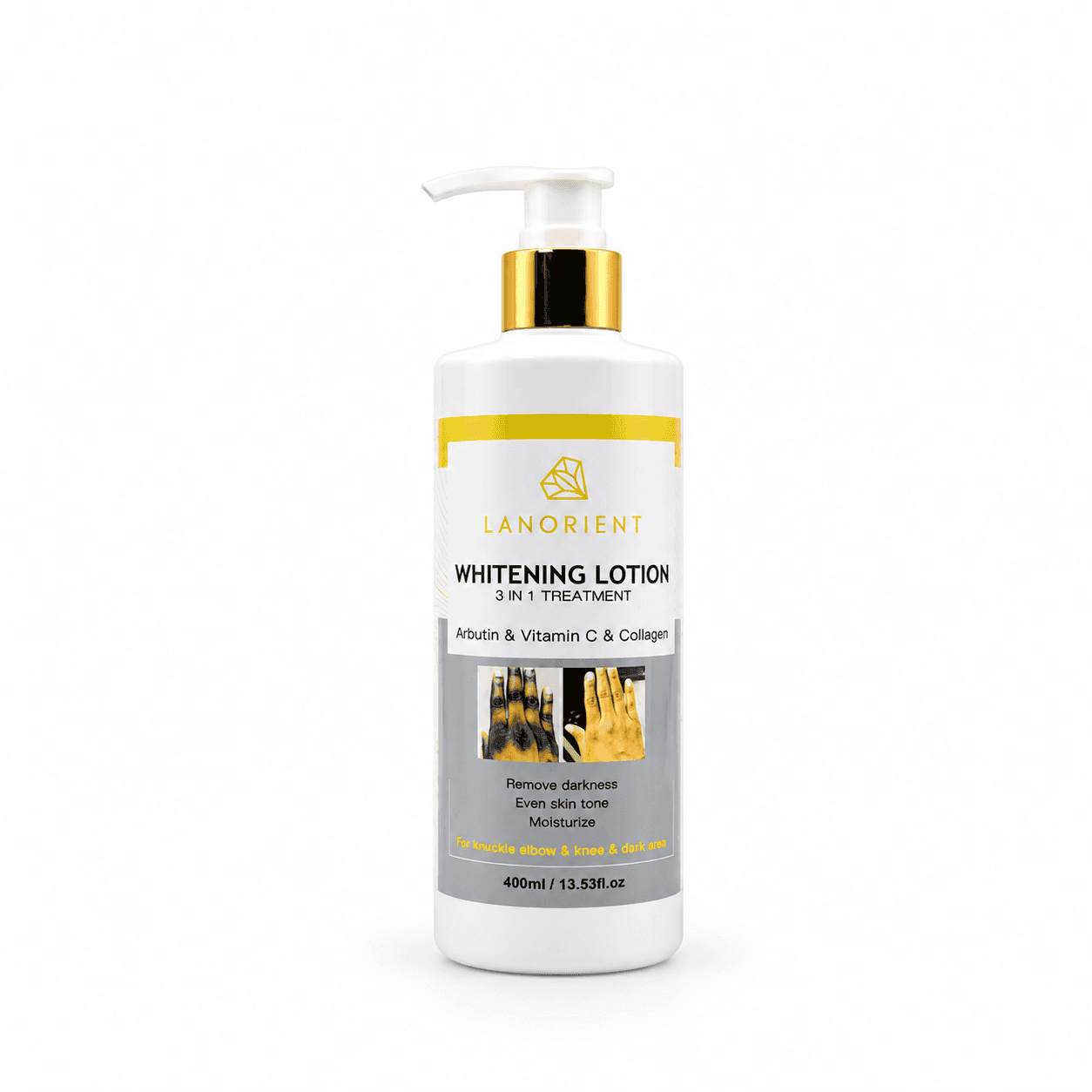 Lanorient Whitening Lotion 3-in-1 Treatment